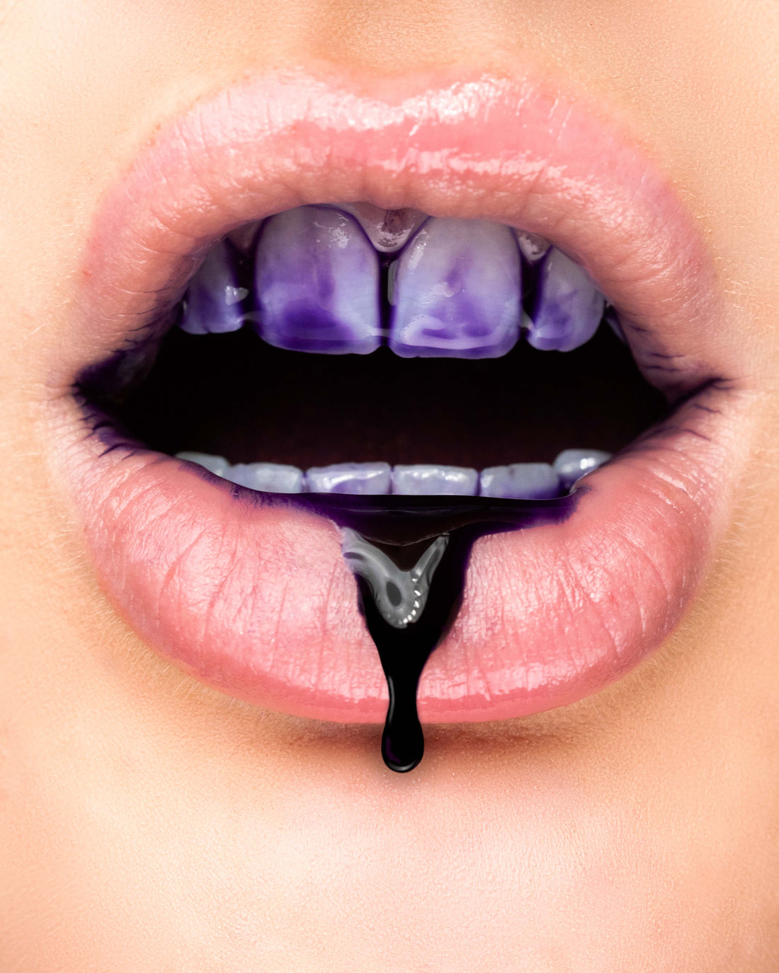 Tannbleking hjemme: hva du bør vite før du starter